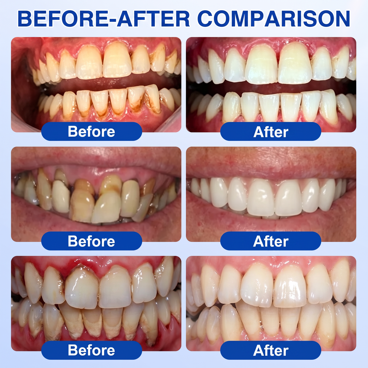 🇬🇧Purelora® 🦷 GumRevive periodontal repair gel 💖