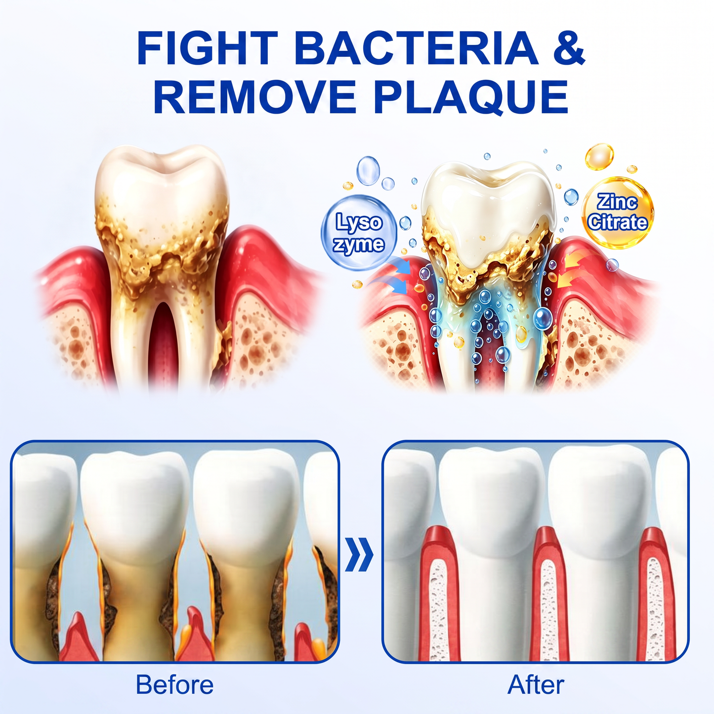 🇬🇧Purelora® 🦷 GumRevive periodontal repair gel 💖
