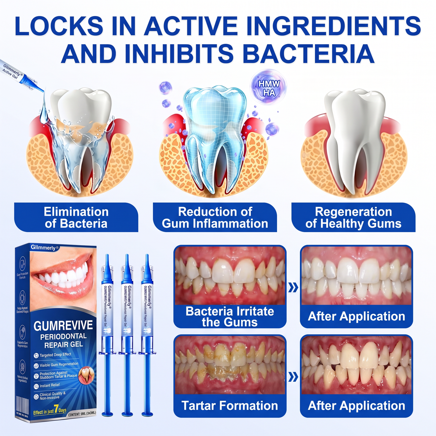 🇬🇧Purelora® 🦷 GumRevive periodontal repair gel 💖