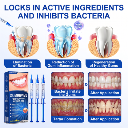 🇬🇧Purelora® 🦷 GumRevive periodontal repair gel 💖