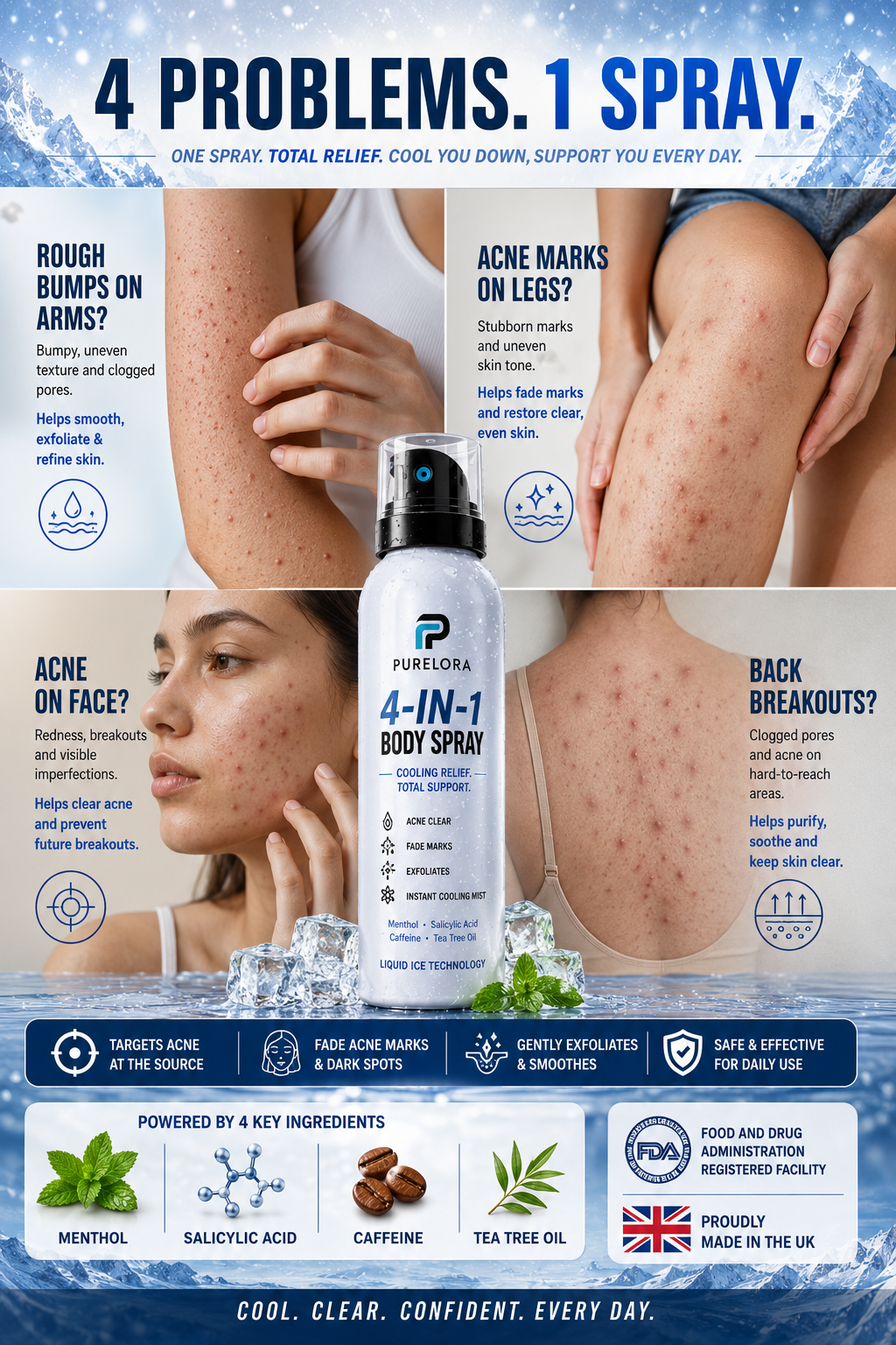 🔥 【Official Store】PURELORA® 4-in-1 Body Spray — Acne Clear · Fade Marks · Smooth Bumps · Exfoliating Mist | Salicylic Acid + Menthol + Caffeine + Tea Tree | Made in UK